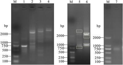 Molecular Cloning of Alternative Splicing Variants of the Porcine PML Gene and Its Expression Patterns During Japanese Encephalitis Virus Infection